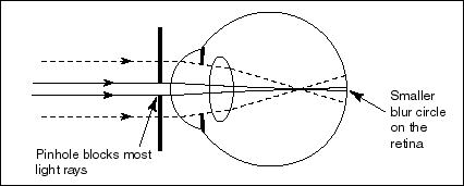 Pinhole lens